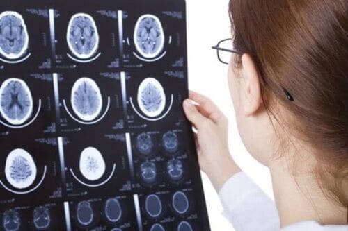 A doctor examines the results of a brain scan.