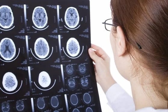 A doctor examines the results of a brain scan.